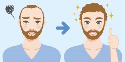 All About Hair Transplant Surgery: Average Cost, Success Rate; Details